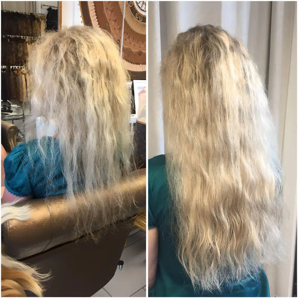 infoltimento come soluzione alla perdita di capelli nelle donne, esempio cliente con foto prima e dopo